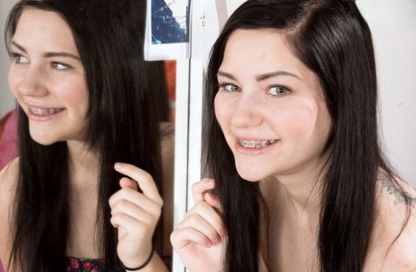 teen braces perfect pictures