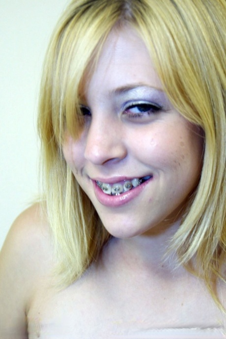 teen braces hot picture