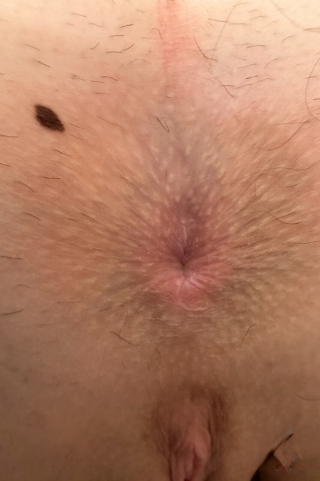 teen butthole hot archive